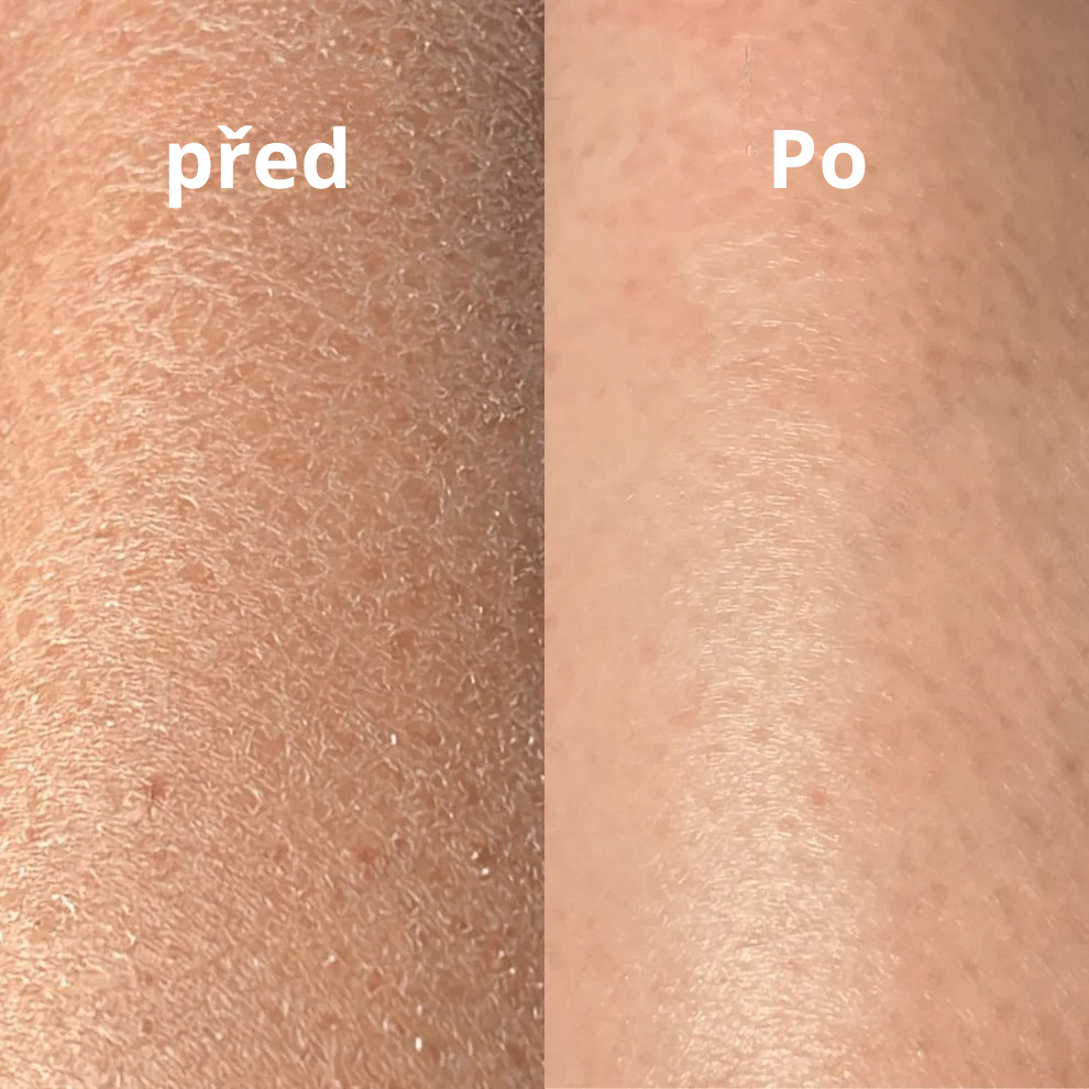 Peelingová rukavice Yuna